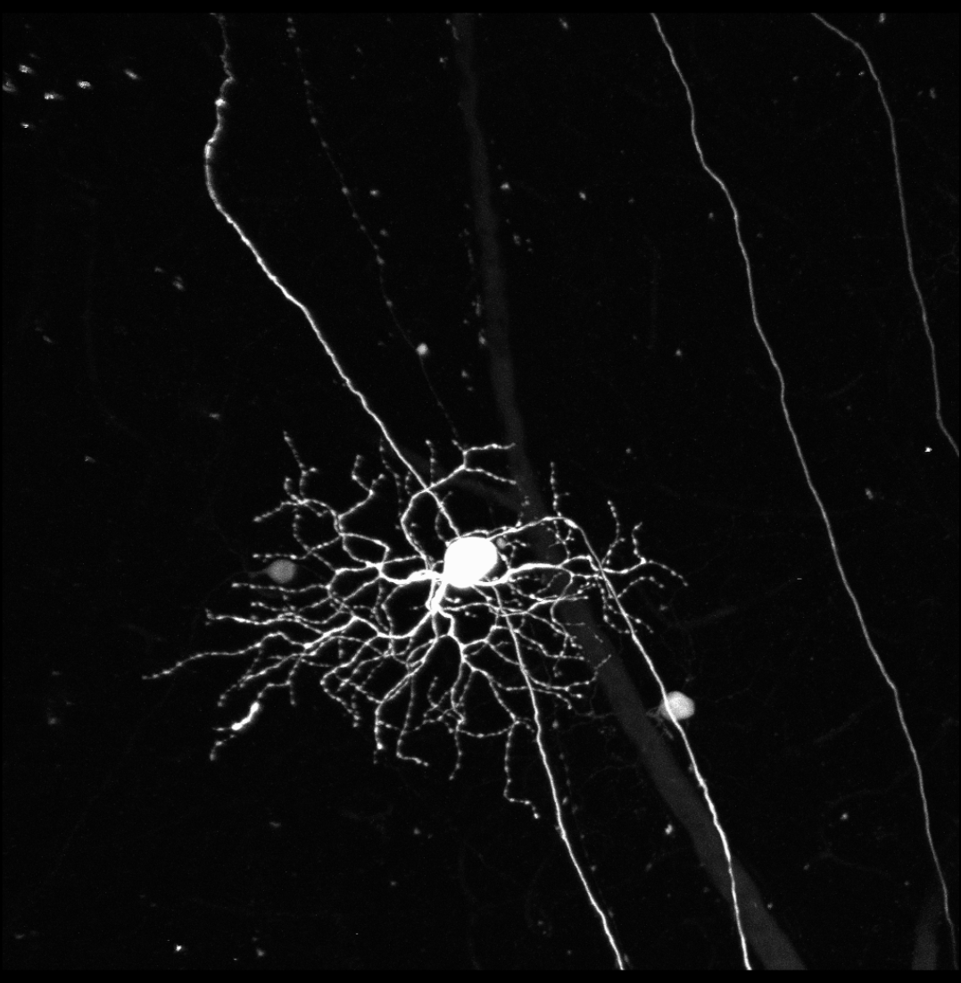 Retinal ganglion cell